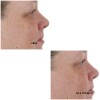 PERRICONE MD (16)